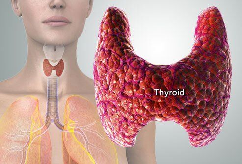 Illustration of thyroid symptoms